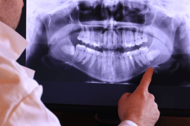 Best Weekend Emergency Dental Services in Bonduel, WI